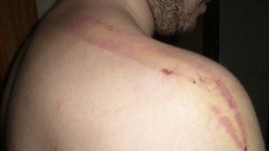 Photo of Разказът на бащата на пребития от цигани Ивайло (+снимки)
